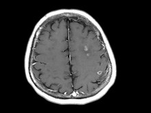 MRI　2.jpg
